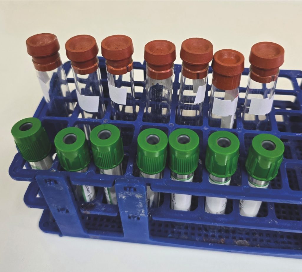 AGROCOLUN 79 | NUTRICIÓN |Perfiles Metabólicos: Parte 1
¡Herramienta Diagnóstica Muy Antigua y Poco Usada!