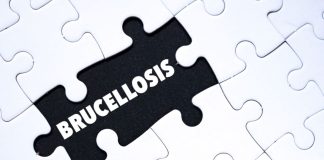 AGROCOLUN 80 | CALIDAD DE LECHE | Lucha contra la Brucelosis Bovina