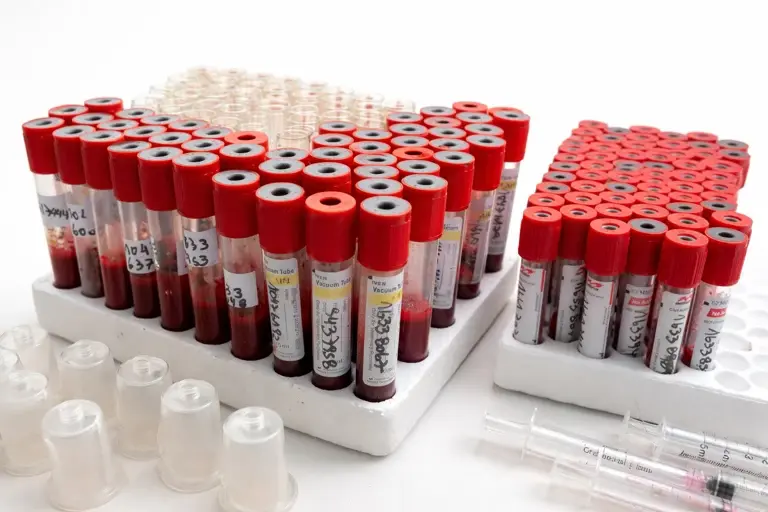 AGROCOLUN Edición 82 | Control de Paratuberculosis Resultados Validados y Compromiso Sanitario de Colun en el Sur de Chile | AGROCOLUN Edición 82 AGROCOLUN Edición 82 | Control de Paratuberculosis Resultados Validados y Compromiso Sanitario de Colun en el Sur de Chile | AGROCOLUN Edición 82